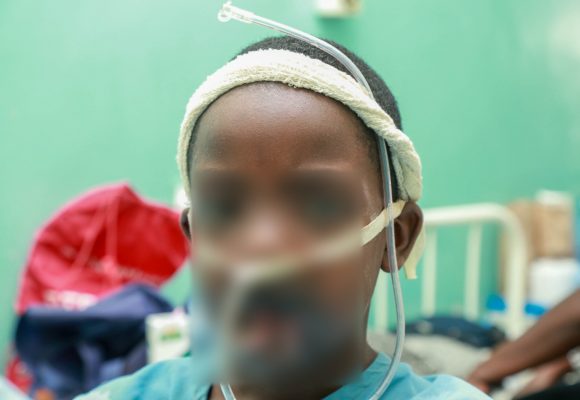 JOOTRH Surgeons Restores 12-Year-Old’s Face After Battery Explosion.