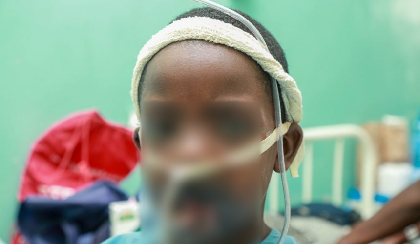 JOOTRH Surgeons Restores 12-Year-Old’s Face After Battery Explosion. JOOTRH Surgeons Restores 12-Year-Old’s Face After Battery Explosion.