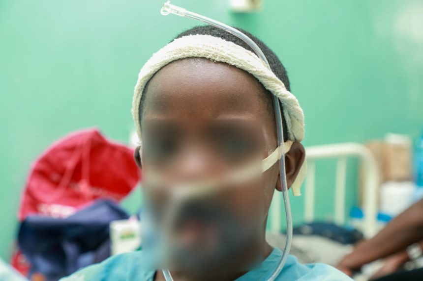 JOOTRH Surgeons Restores 12-Year-Old’s Face After Battery Explosion. JOOTRH Surgeons Restores 12-Year-Old’s Face After Battery Explosion.
