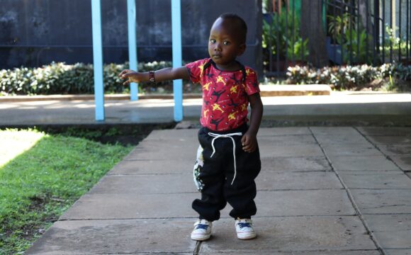 Early Treatment Helps Two-Year-Old Take His First Steps